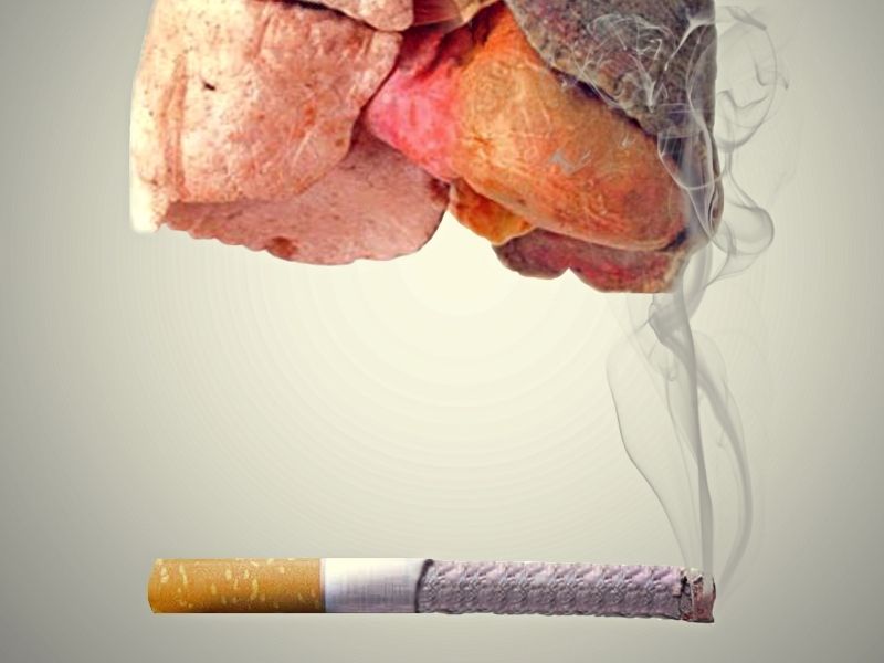 Smoking and Lung Cancer