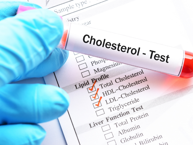 What Are The Preventive Health Checkup Tests That One Should Take After Turning 30?