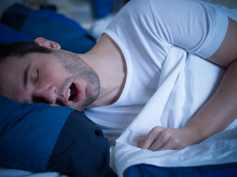 What causes Sleep Apnea?