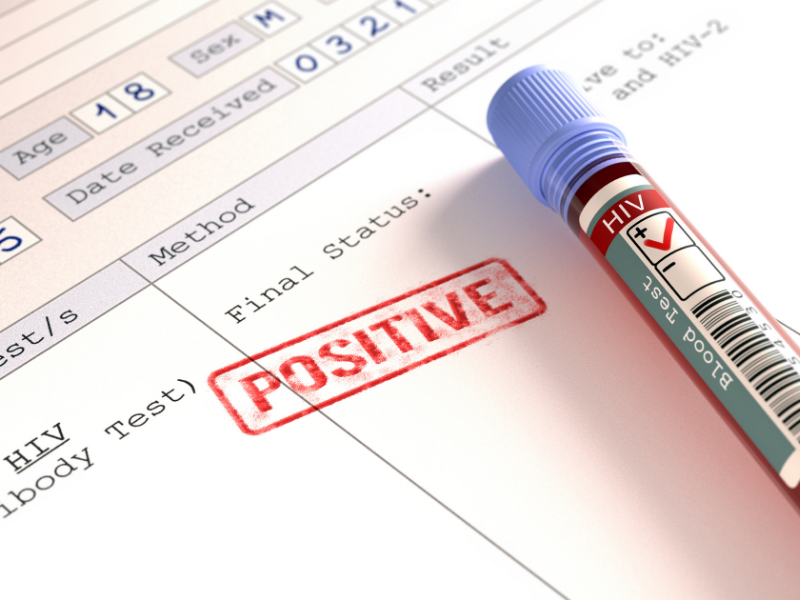 Should you get tested for HIV regularly? | HIV testing in Mangalore