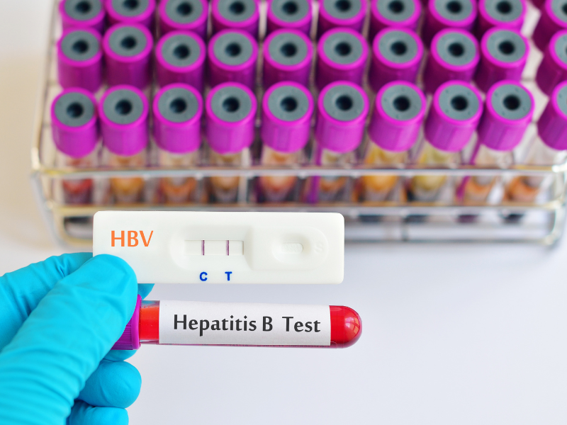 Hepatitis B virus (HBV)