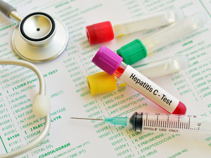 Hepatitis C virus (HCV)