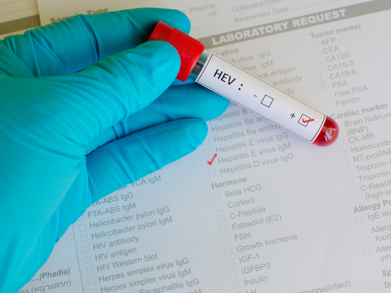 Hepatitis E virus (HEV) 