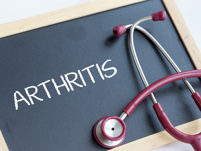 What is Arthritis